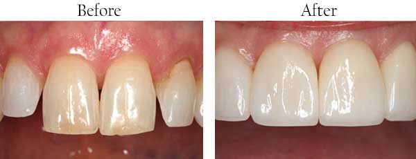 dental images 96761